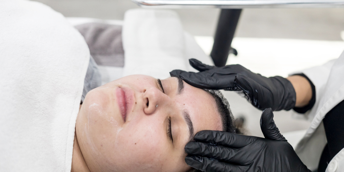 Chemical Peels Halo Med Spa